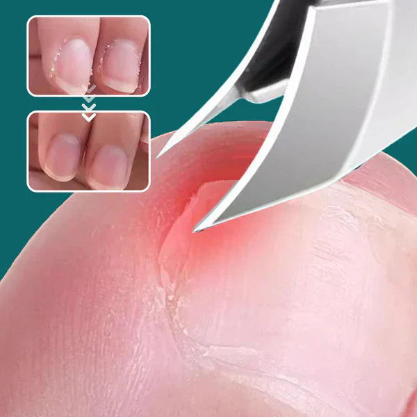 Anti-Splash Vinklad Nagelsax 3-delars Set